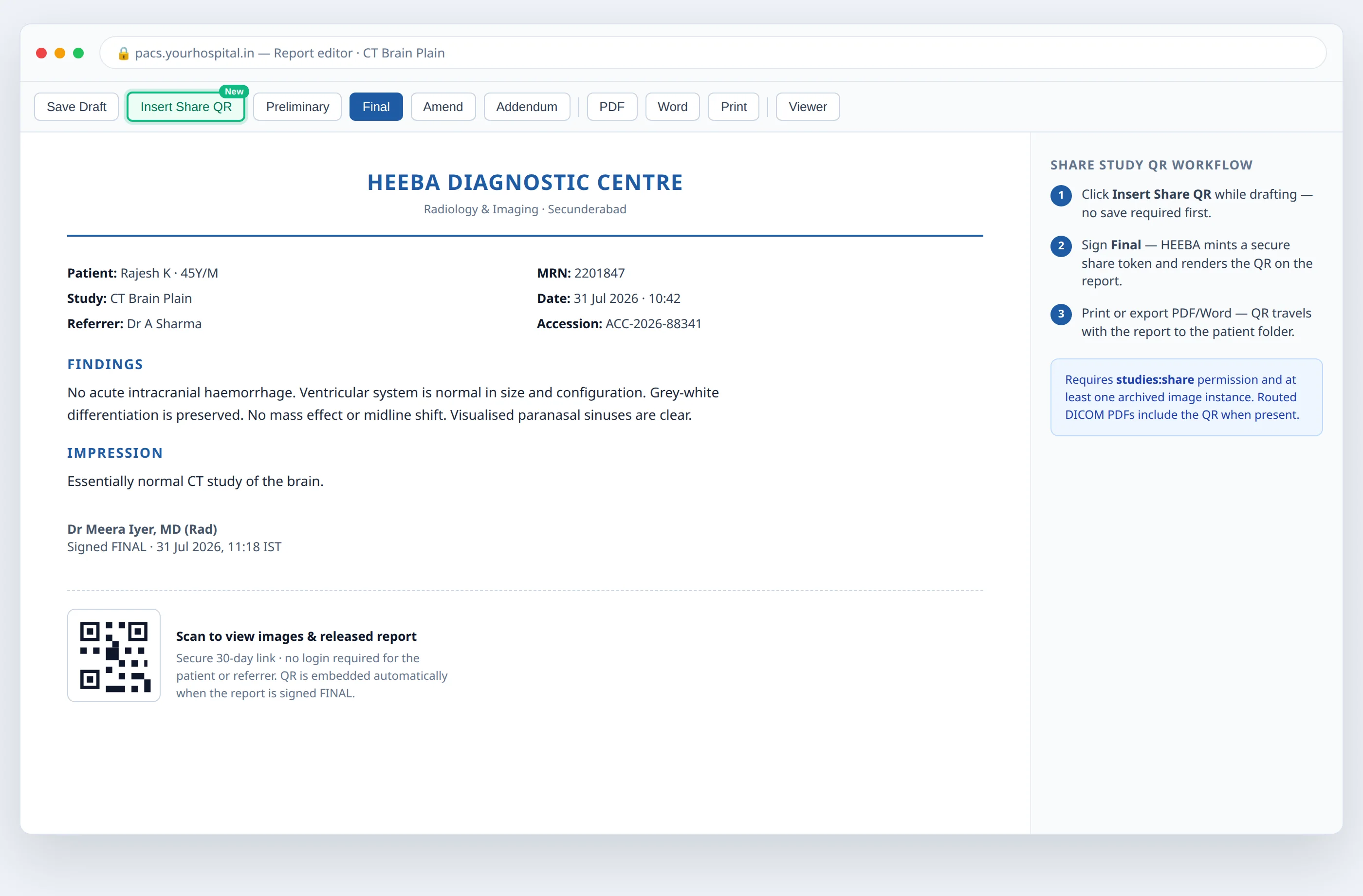 HEEBA Insert Share QR toolbar and signed report with embedded QR code